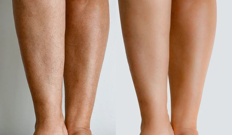 Painless Cream Wax + Strip Pack ( Free )
