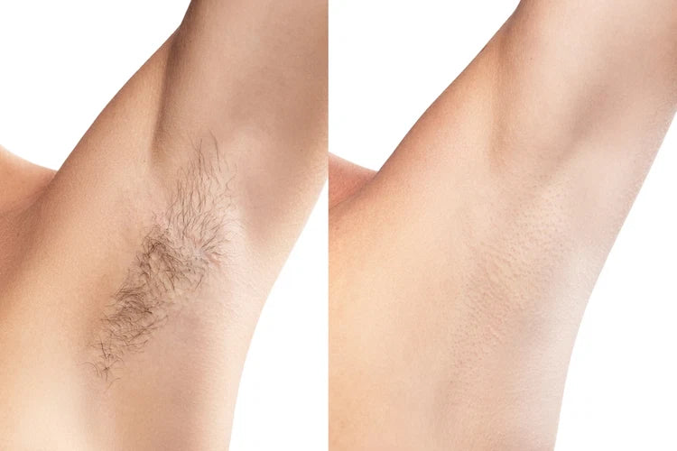 Painless Cream Wax + Strip Pack ( Free )