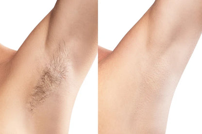 Painless Cream Wax + Strip Pack ( Free )